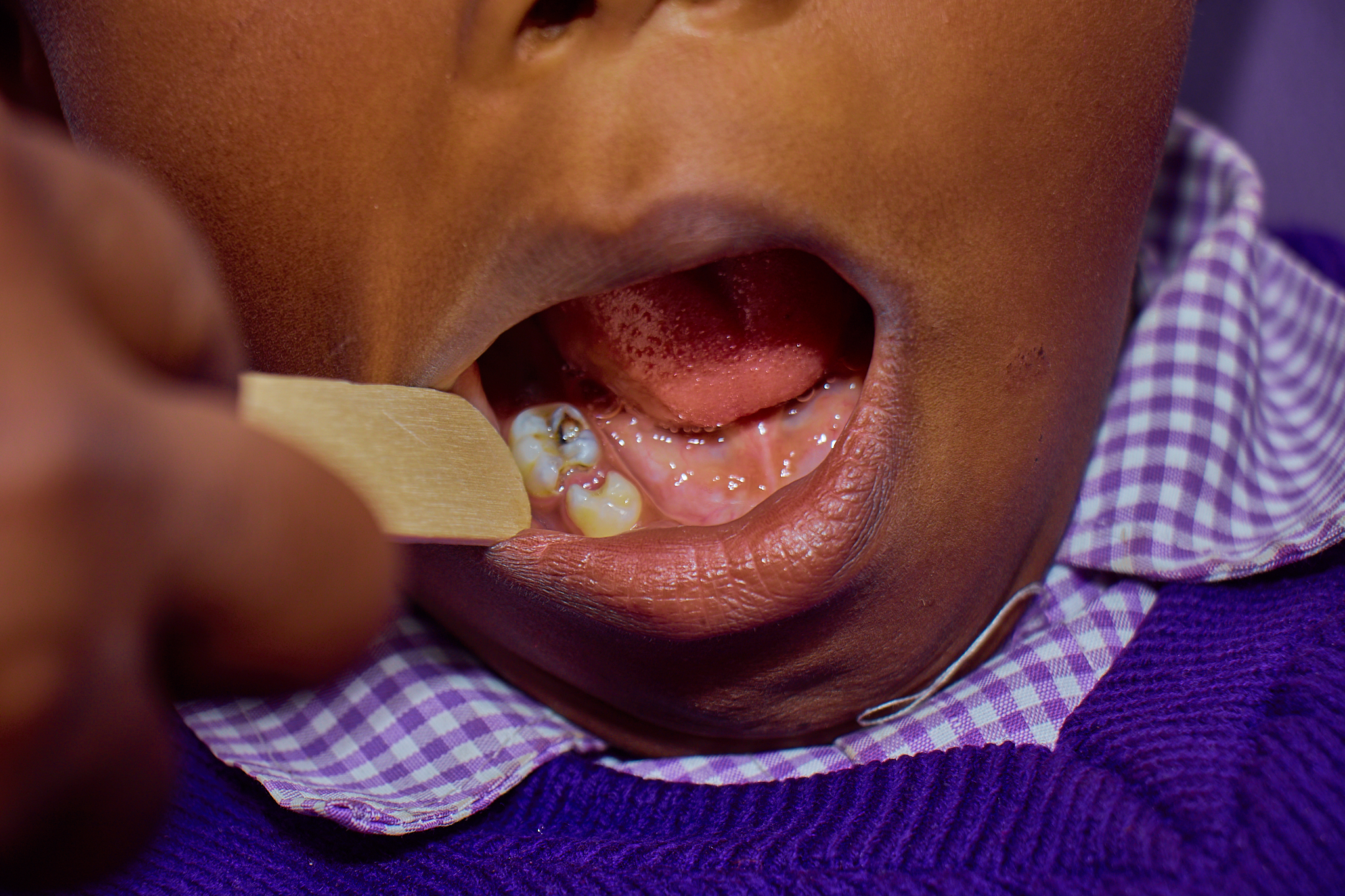 Dental Outreach (27 January 2025)