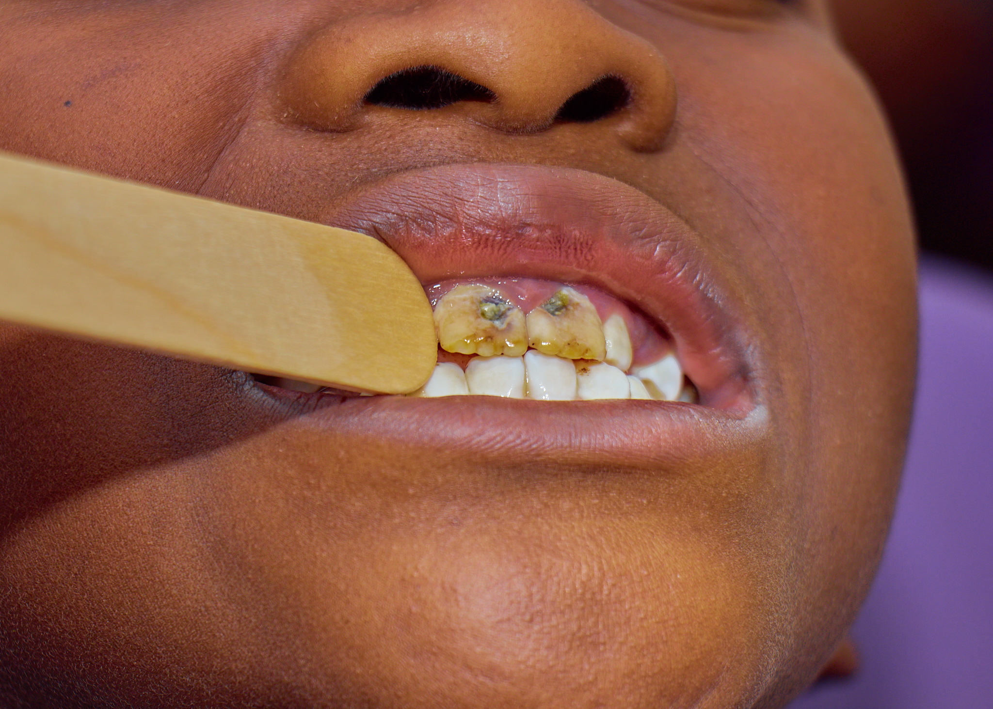 Dental Outreach (27 January 2025)