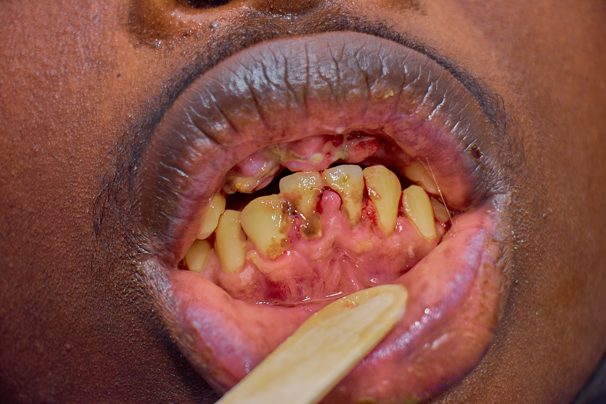 Dental Outreach (27 January 2025)